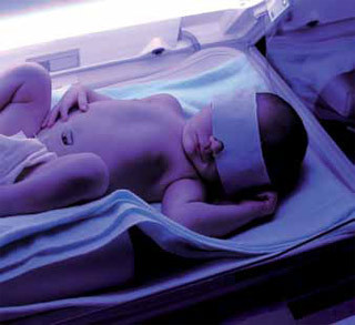 Click image for larger version

Name:	jaundice-phototherapy.jpg
Views:	1074
Size:	27.0 KB
ID:	1710066